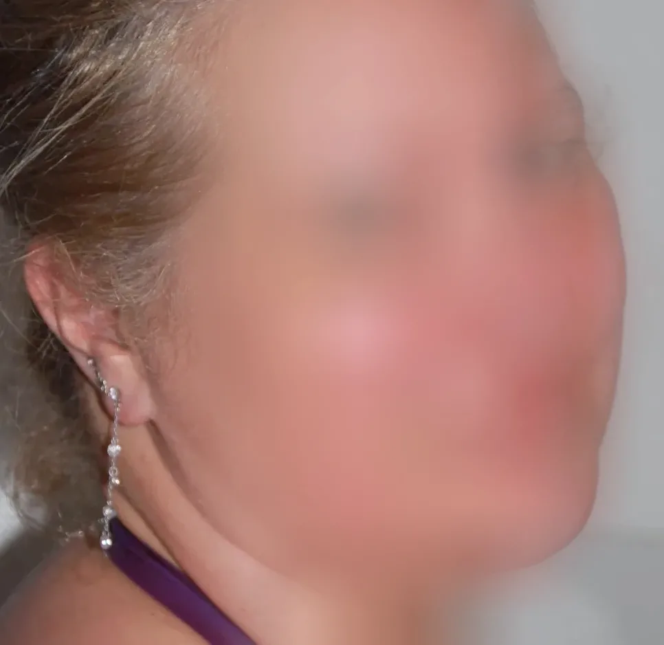 Carina, 28